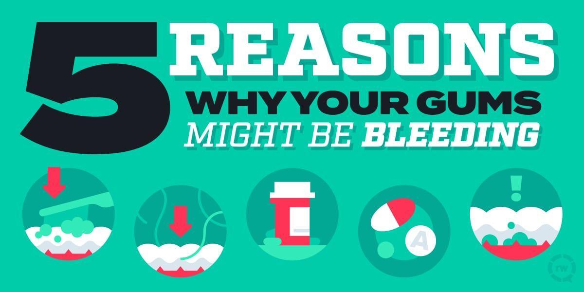 5 Reasons Why Your Gums Might Be Bleeding
